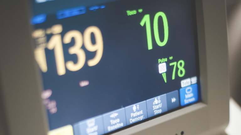 Read more about the article Cardioversion