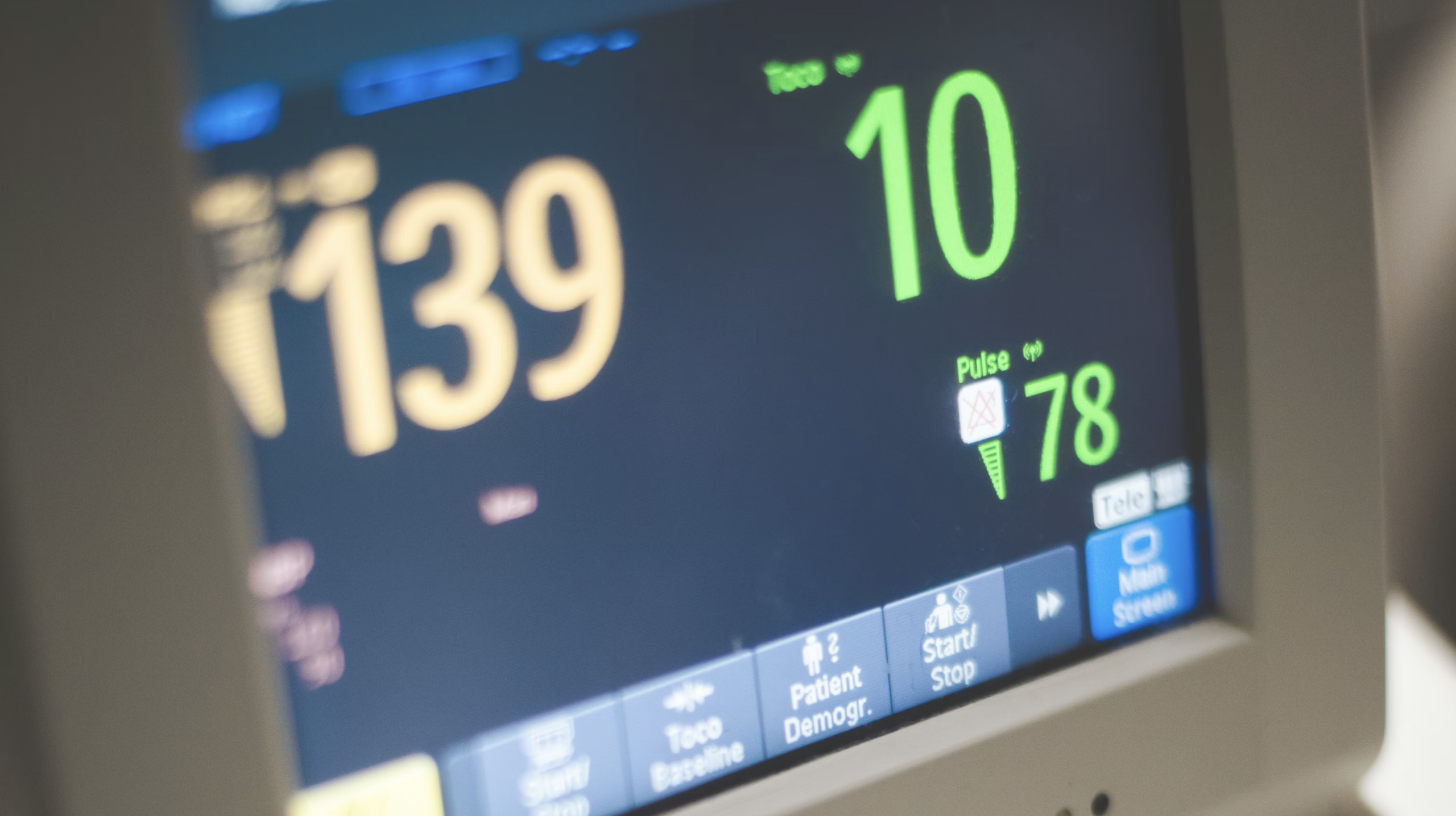 Read more about the article Cardioversion