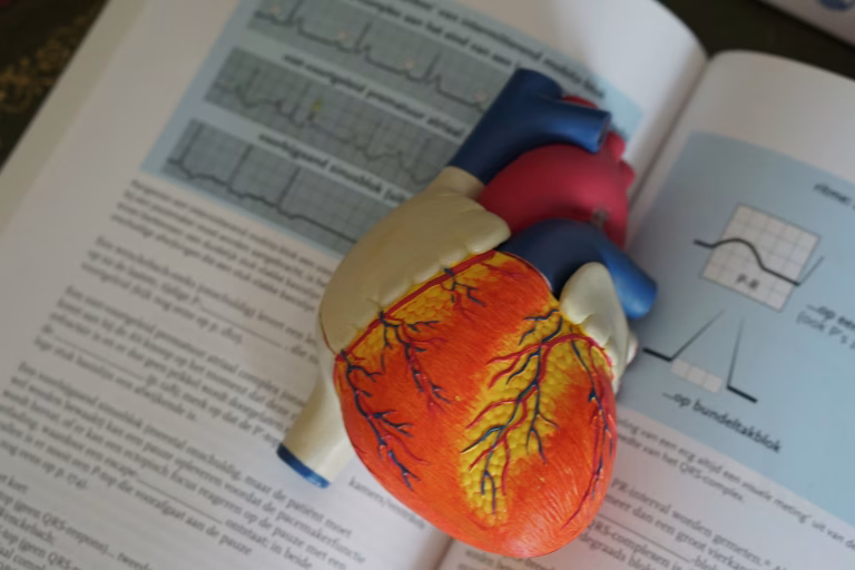 Read more about the article Atrial Fibrillation and me